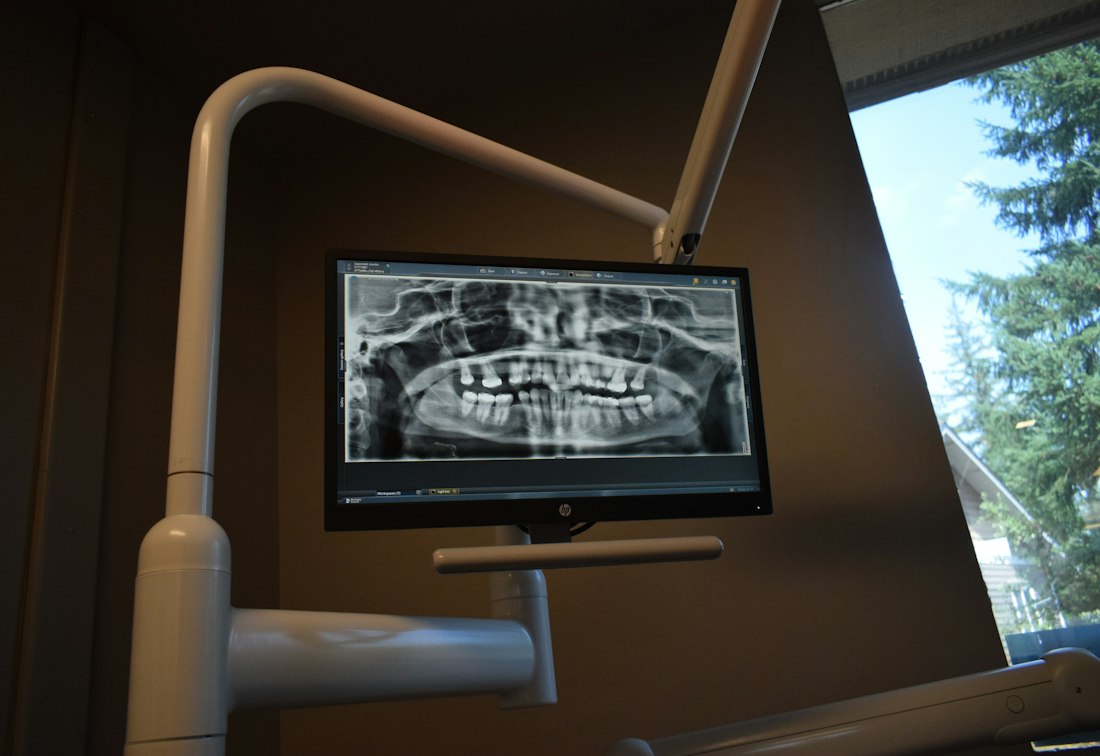 How AI is revolutionizing early cavity detection